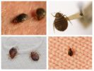 Linen bugs