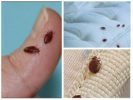 Bedbugs vücutta ve yatakta