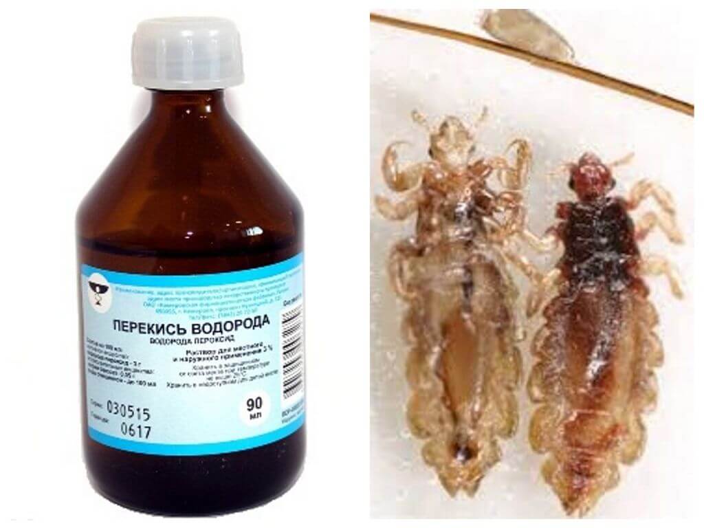 Ang hydrogen peroxide mula sa mga kuto at nits