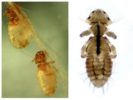 Lice-1