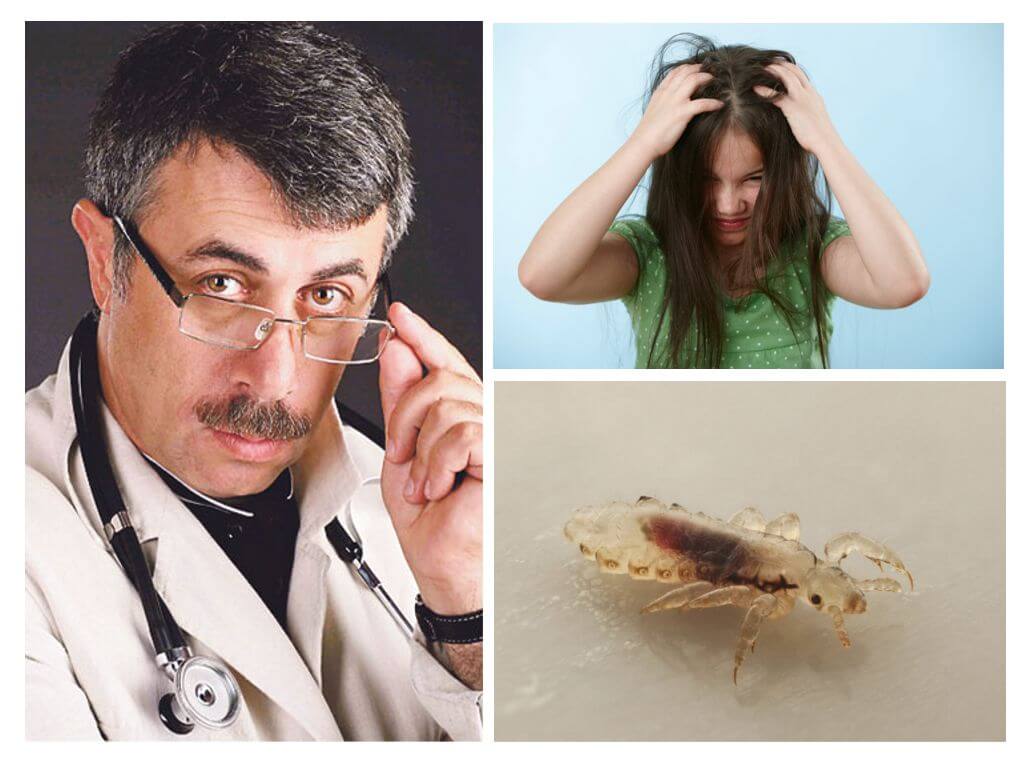 Dr. Komarovskys råd om pediculosis