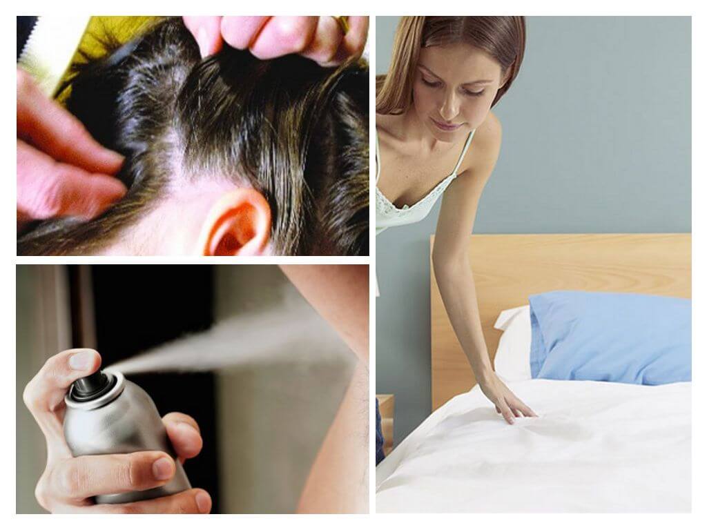 Pediculosis Memo para sa mga Magulang