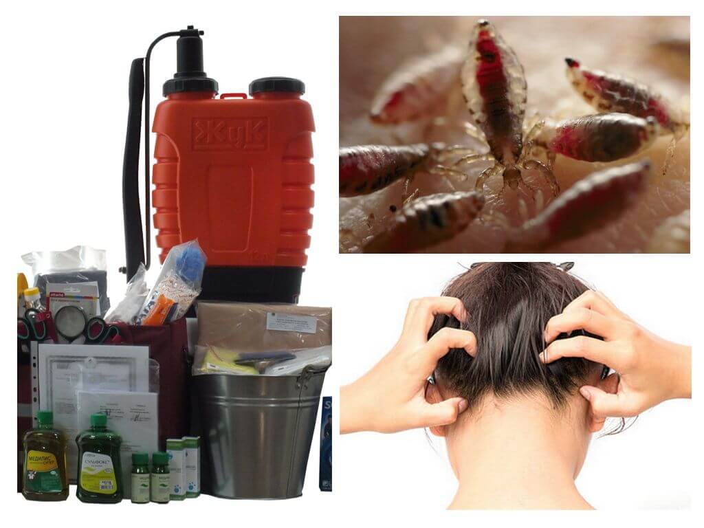 Ano ang istilo ng anti-pediculosis?