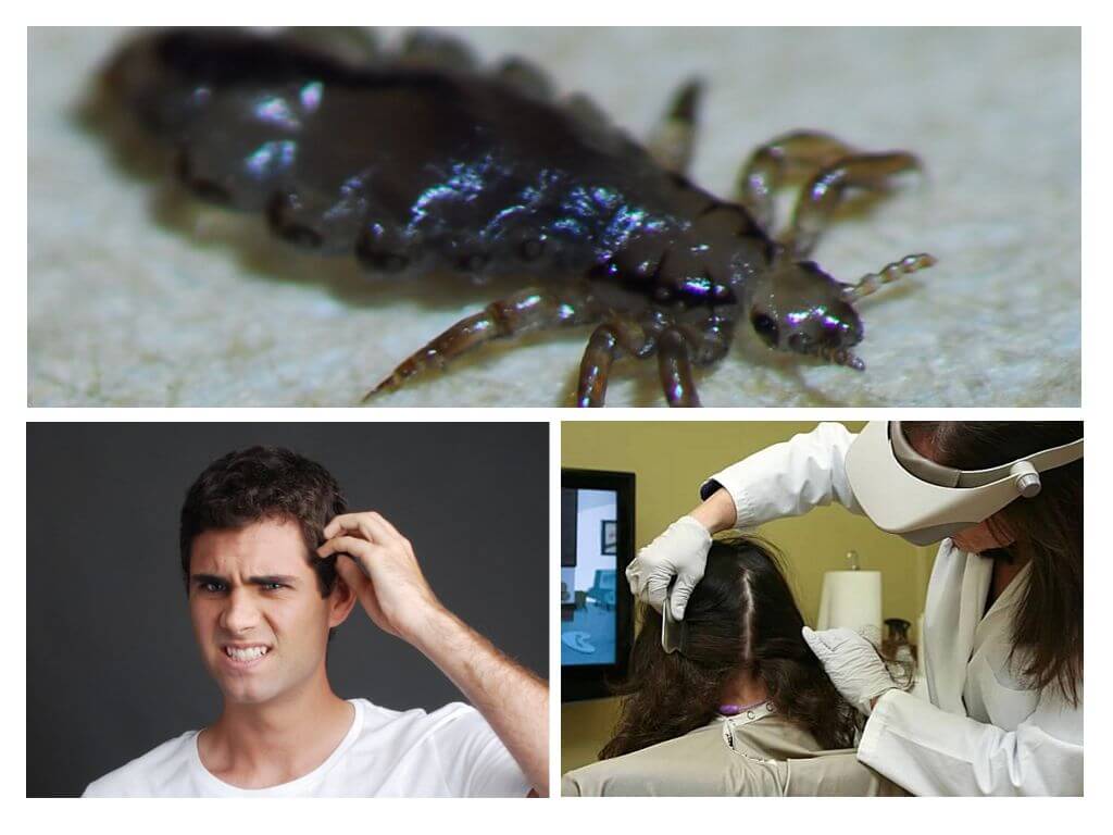 Algorithm Examination ng Pediculosis