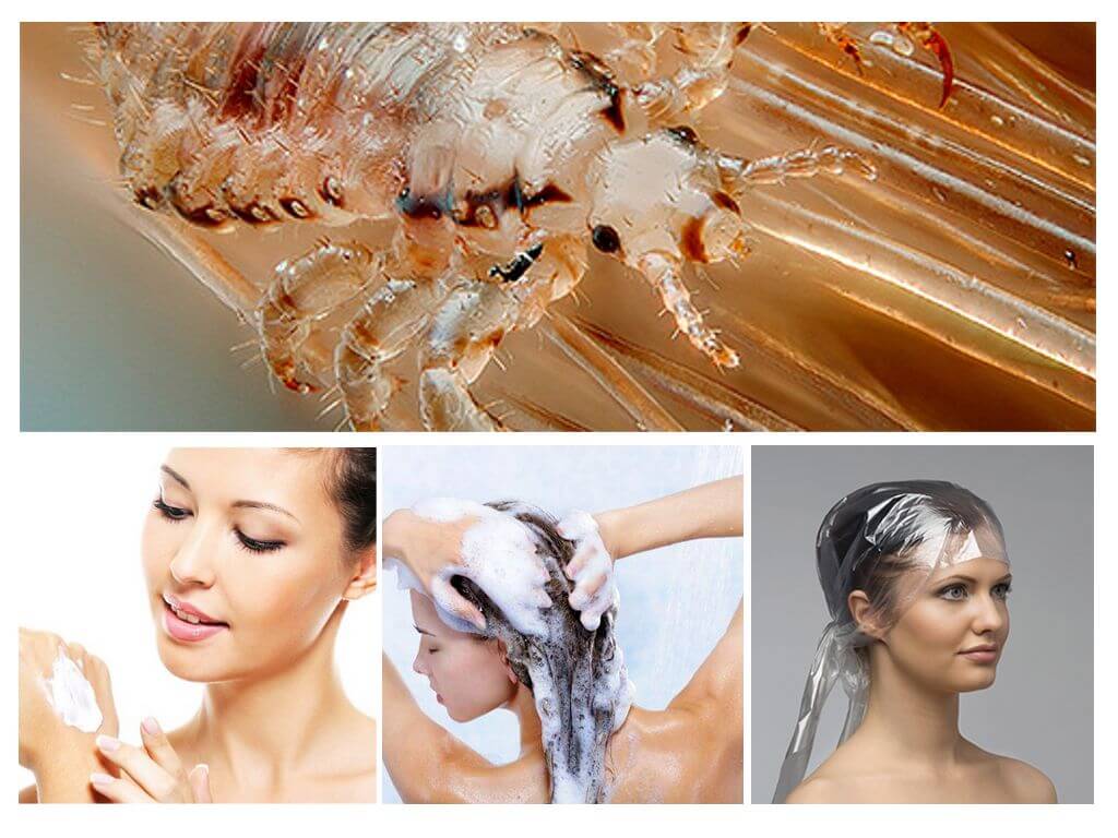 Pediculosis-shampoo til børn og voksne