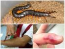 Scolopendra-pureman vaara