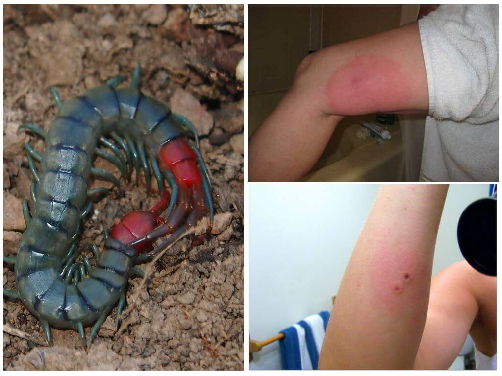 Wat te doen als een scolopendra heeft gebeten