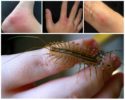 Ang kagat ng Centipede