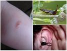 Morso di Earwig