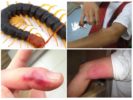Scolopendra purema