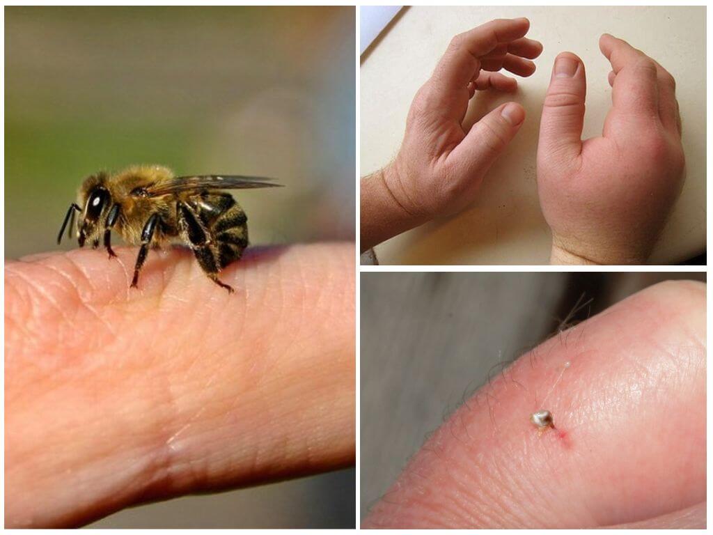 Mikä on mehiläisen piikki hyödyllinen henkilölle
