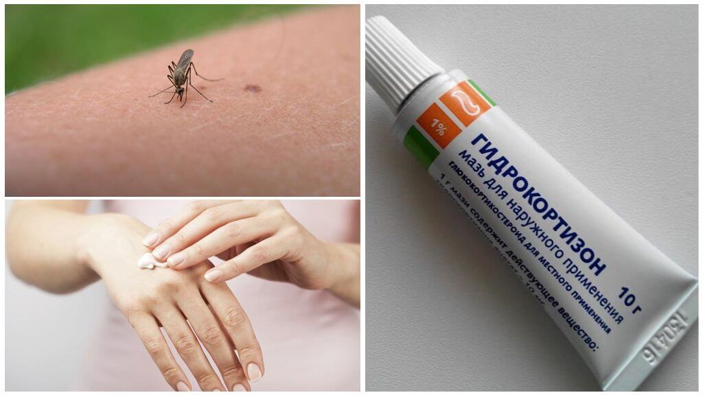 Unguento all'idrocortisone per punture di zanzara