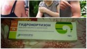 Indikácie pre použitie hydrokortizónovej masti