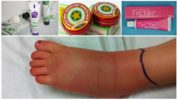 Naturlig ben tumor tumor behandling
