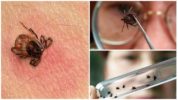 L’estudi de la paparra i les seves partícules