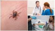 Diagnosis ng monocytic ehrlichiosis sa mga tao