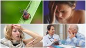 Mga uri ng Encephalitis na may dala-tiket