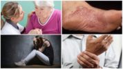 Mga sintomas ng talamak na yugto ng borreliosis