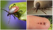 Encephalitis Mites