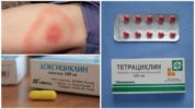 Paggamot ng monocytic ehrlichiosis sa mga tao