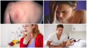 Sintomas ng Borreliosis