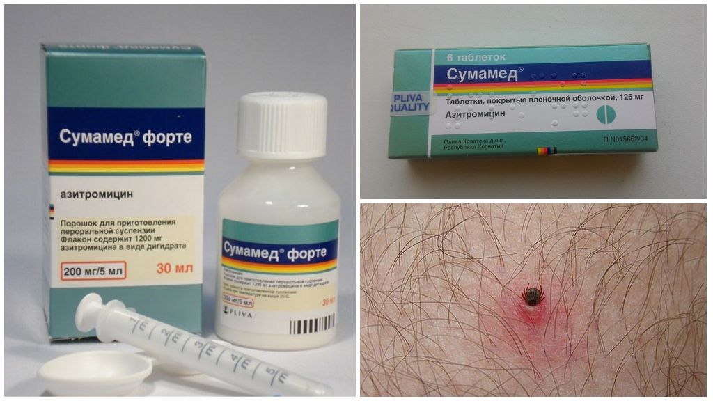 Antibiòtics després d’una picada de garrapates