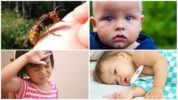 Systemische allergieën na een wespensteek