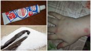 Unguento alla vaniglia di zanzare e moscerini