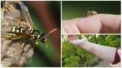 Wasp sting