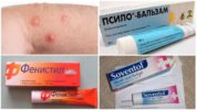 Antihistamine-zalven voor insectenbeten