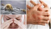 Alikabok mite allergy