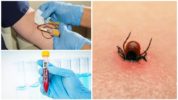 Encefalitis bloedtest