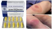 Doxycycline na may Borreliosis