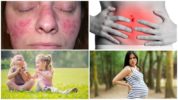 Contraindications sa pagkuha ng doxycycline