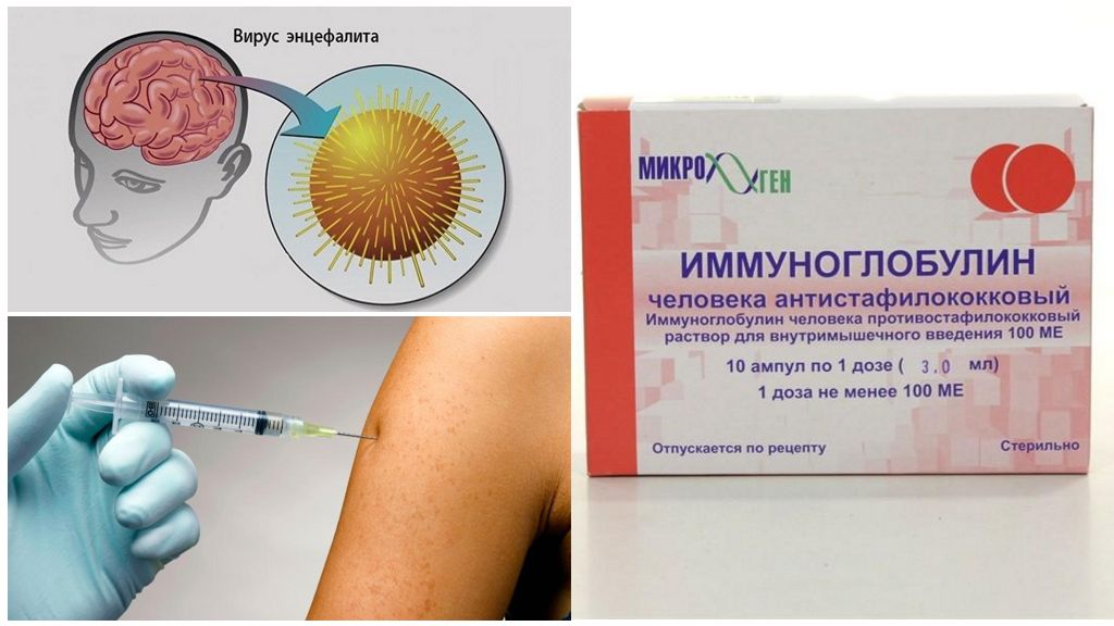 Mga komplikasyon ng encephalitis na may tik na tik sa mga tao