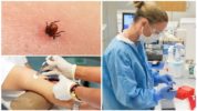 Blodprøve for encephalitis og borreliose