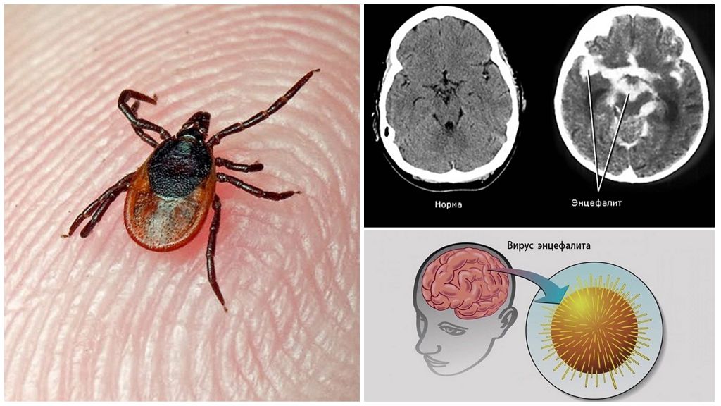 Laboratoriediagnostik af tick-båret encephalitis og borreliose