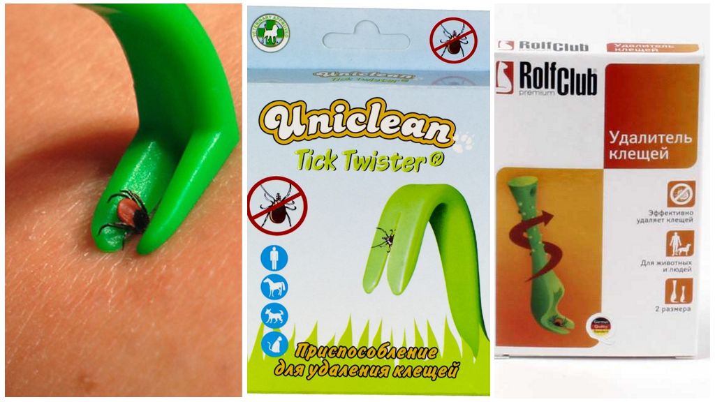 Mijtextractieapparaten: pincet, tondeuse, pincet