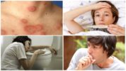 Borrelioosin oireet
