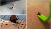 Mètodes d’extracció de tick
