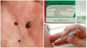 Door teken overgedragen encefalitisvaccinatie