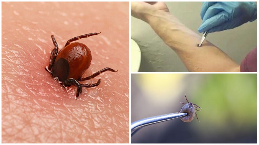 Mayroon bang anumang mga ticks sa Sochi