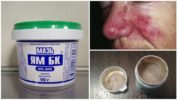 Ang Ointment Yam mula sa demodicosis