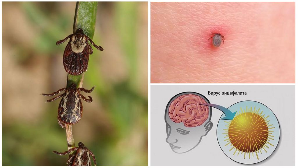 Pag-iwas sa impeksyong encephalitis: pag-iingat, ticks