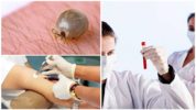 Encefalitis bloedtest